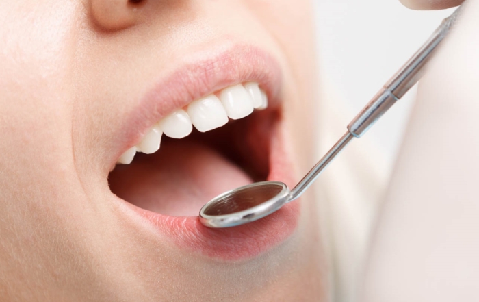 Wisdom Teeth Guelph Royal Dental Centre Guelph Dentist